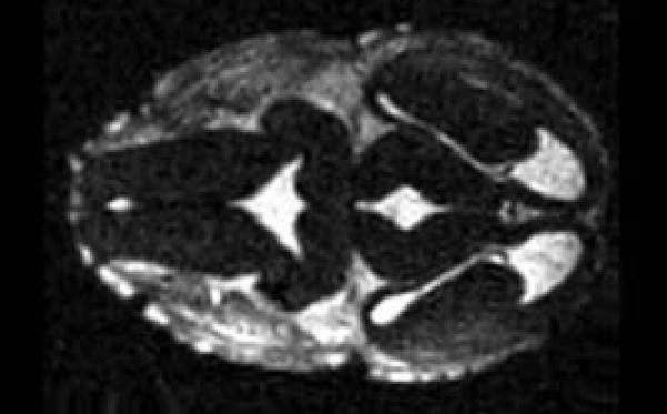 Développement d'Aimants compacts pour la RMN